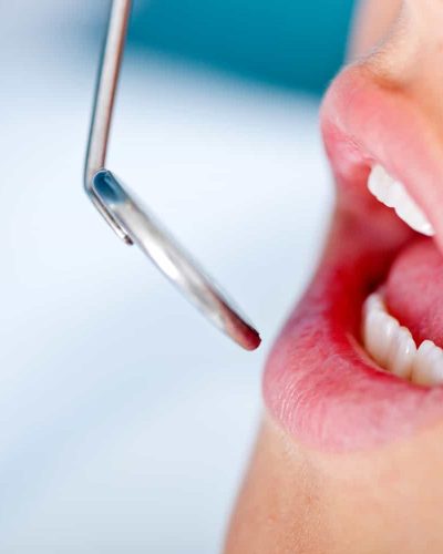 Visit to the dentist